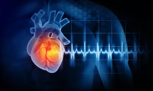 2023 Australian guideline for assessing and managing cardiovascular disease risk