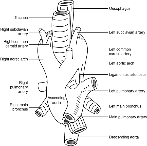 Biphasic Stridor In Infancy