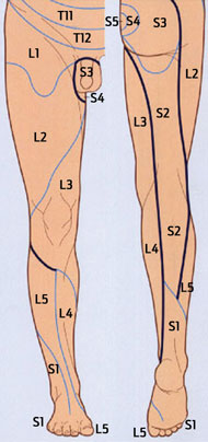 Auto pesnica Susnježica left leg weakness alge softver Comorama