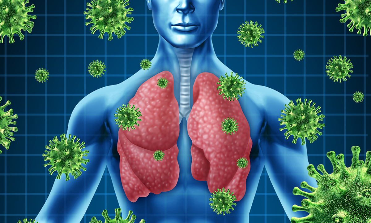 Antibiotics for acute respiratory infections in general practice