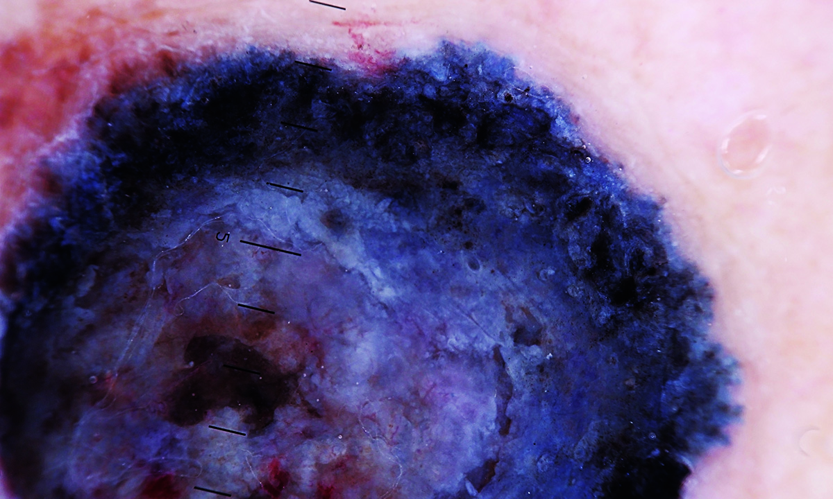 Clinical practice guidelines for the diagnosis and management of