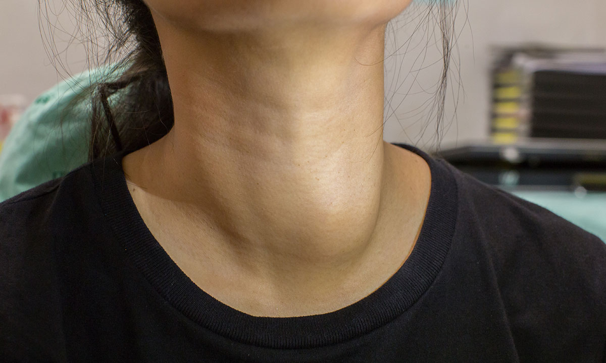 Thyroid Nodules Diagnosis And Management The Medical Journal Of