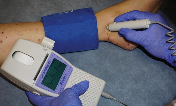 How to perform the ankle brachial index test in clinical practice